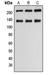 Anti-MLCK antibody used in Western Blot (WB). GTX55159