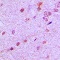 Anti-NeuroD2 antibody used in IHC (Paraffin sections) (IHC-P). GTX55161