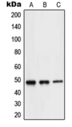 Anti-NeuroD2 antibody used in Western Blot (WB). GTX55161