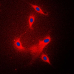 Anti-PPP2R1B antibody used in Immunocytochemistry/ Immunofluorescence (ICC/IF). GTX55165