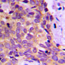 Anti-PRKAR1B antibody used in IHC (Paraffin sections) (IHC-P). GTX55166