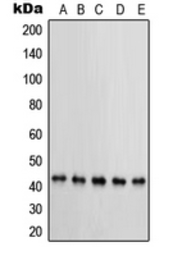 Anti-PRKAR1B antibody used in Western Blot (WB). GTX55166