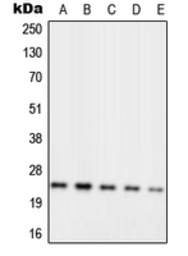 Anti-RPL10 antibody used in Western Blot (WB). GTX55169