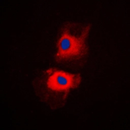 Anti-RPL27A antibody used in Immunocytochemistry/ Immunofluorescence (ICC/IF). GTX55170