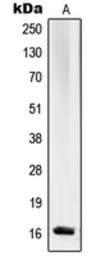 Anti-RPL27A antibody used in Western Blot (WB). GTX55170