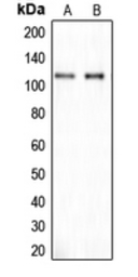 Anti-CYLN2 antibody used in Western Blot (WB). GTX55177
