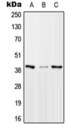 Anti-MTERF antibody used in Western Blot (WB). GTX55178