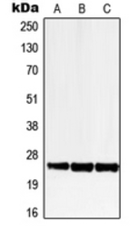 Anti-LRAT antibody used in Western Blot (WB). GTX55182