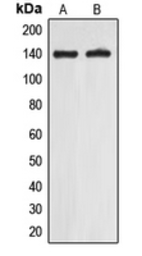 Anti-EIF5B antibody used in Western Blot (WB). GTX55185