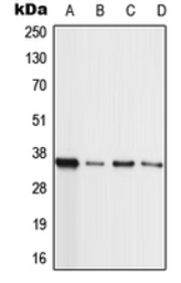 Anti-MLL4 antibody used in Western Blot (WB). GTX55187