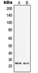 Anti-PGRMC2 antibody used in Western Blot (WB). GTX55189