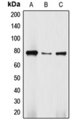 Anti-DBF4 antibody used in Western Blot (WB). GTX55192