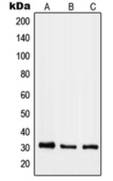 Anti-RAB40B antibody used in Western Blot (WB). GTX55194