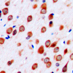 Anti-Neurotrimin antibody used in IHC (Paraffin sections) (IHC-P). GTX55202