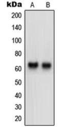 Anti-Neurotrimin antibody used in Western Blot (WB). GTX55202