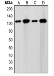 Anti-SENP7 antibody used in Western Blot (WB). GTX55205