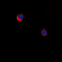 Anti-ARRDC1 antibody used in Immunocytochemistry/ Immunofluorescence (ICC/IF). GTX55210