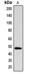 Anti-ARRDC1 antibody used in Western Blot (WB). GTX55210