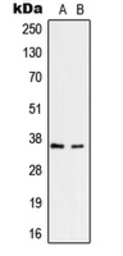 Anti-RNF113B antibody used in Western Blot (WB). GTX55212