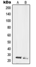 Anti-RPL10L antibody used in Western Blot (WB). GTX55213