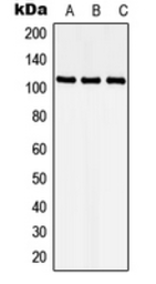 Anti-CDKL5 antibody used in Western Blot (WB). GTX55218