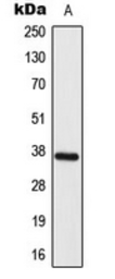 Anti-ELOVL4 antibody used in Western Blot (WB). GTX55225
