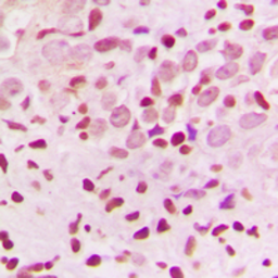 Anti-ZNF174 antibody used in IHC (Paraffin sections) (IHC-P). GTX55226