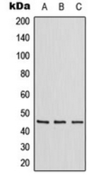 Anti-ZNF174 antibody used in Western Blot (WB). GTX55226