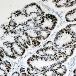 Anti-HBP1 antibody used in IHC (Paraffin sections) (IHC-P). GTX55229