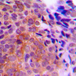 Anti-Casein Kinase 1 gamma antibody used in IHC (Paraffin sections) (IHC-P). GTX55230