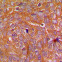 Anti-CARD14 antibody used in IHC (Paraffin sections) (IHC-P). GTX55231
