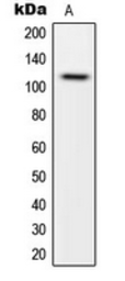 Anti-CARD14 antibody used in Western Blot (WB). GTX55231