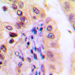 Anti-USP32 antibody used in IHC (Paraffin sections) (IHC-P). GTX55233
