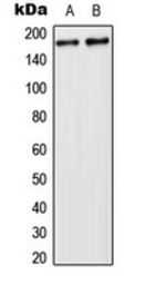 Anti-USP32 antibody used in Western Blot (WB). GTX55233