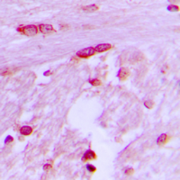 Anti-BTF3L4 antibody used in IHC (Paraffin sections) (IHC-P). GTX55234
