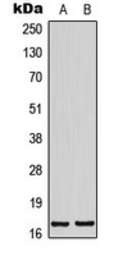 Anti-BTF3L4 antibody used in Western Blot (WB). GTX55234