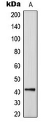Anti-CEP41 antibody used in Western Blot (WB). GTX55235