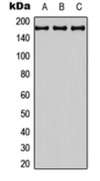 Anti-BAI3 antibody used in Western Blot (WB). GTX55237