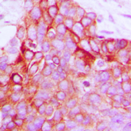 Anti-GPR116 antibody used in IHC (Paraffin sections) (IHC-P). GTX55241