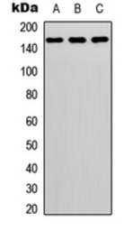 Anti-GPR116 antibody used in Western Blot (WB). GTX55241