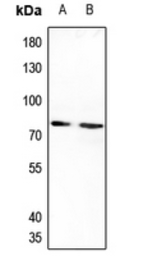 Anti-IL20 Receptor alpha antibody used in Western Blot (WB). GTX55245