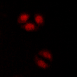 Anti-p107 antibody used in Immunocytochemistry/ Immunofluorescence (ICC/IF). GTX55251