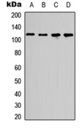 Anti-p107 antibody used in Western Blot (WB). GTX55251