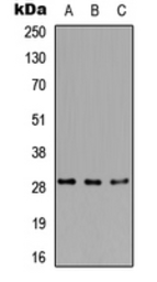 Anti-RPA4 antibody used in Western Blot (WB). GTX55252
