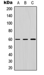 Anti-ZNF496 antibody used in Western Blot (WB). GTX55254