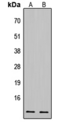 Anti-CDK2AP1 antibody used in Western Blot (WB). GTX55259