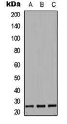 Anti-EBI3 antibody used in Western Blot (WB). GTX55263