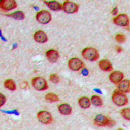 Anti-GTPBP5 antibody used in IHC (Paraffin sections) (IHC-P). GTX55267