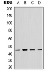 Anti-GTPBP5 antibody used in Western Blot (WB). GTX55267