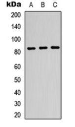 Anti-Beta-glucuronidase antibody used in Western Blot (WB). GTX55268